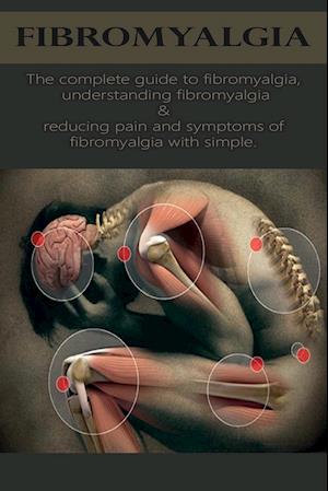 Fibromyalgia