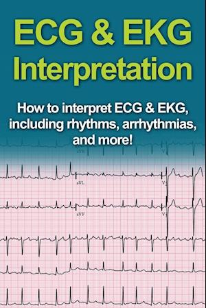 ECG & EKG Interpretation