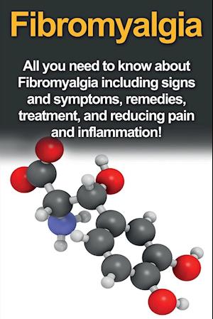 Fibromyalgia