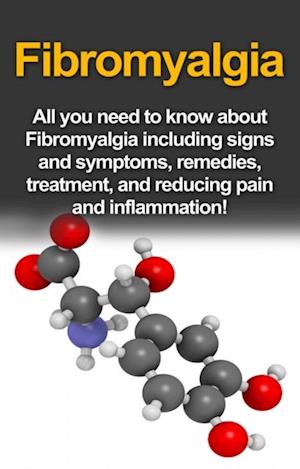 Fibromyalgia