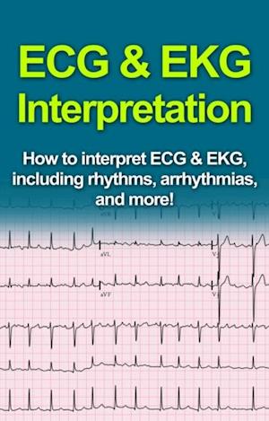 ECG & EKG Interpretation