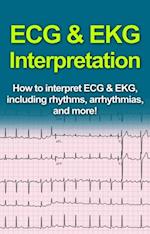 ECG & EKG Interpretation