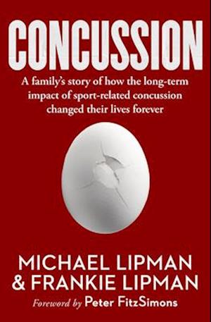 Concussion