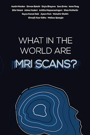 What in the world are MRI Scans?