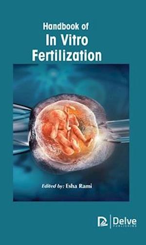 Handbook of in Vitro Fertilization