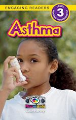 Asthma