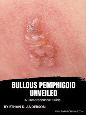 Bullous Pemphigoid Unveiled: A Comprehensive Guide