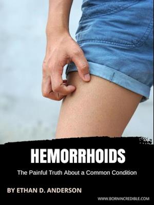 Hemorrhoids: The Painful Truth About a Common Condition