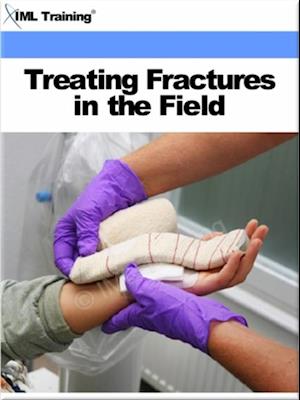 Treating Fractures in the Field (Injuries and Emergenices)