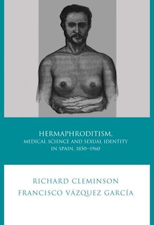 Hermaphroditism, Medical Science and Sexual Identity in Spain, 1850-1960