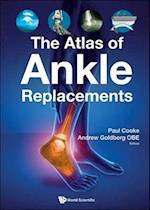 The Atlas of Ankle Replacements