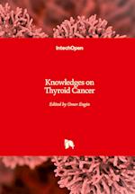 Knowledges on Thyroid Cancer