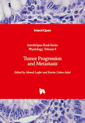 Tumor Progression and Metastasis