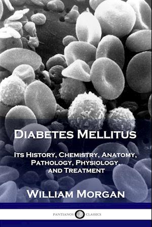 Diabetes Mellitus