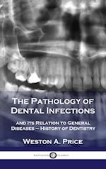 Pathology of Dental Infections