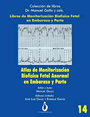 Atlas de Monitorizacion Biofisica Fetal Anormal En El Embarazo Y Parto