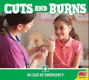 Cuts and Burns