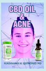 CBD Oil and Acne