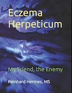 Eczema Herpeticum