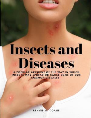 Insects and Diseases - A Popular Account of the Way in Which Insects may Spread or Cause some of our Common Diseases