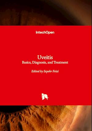 Uveitis