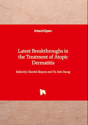 Latest Breakthroughs in the Treatment of Atopic Dermatitis