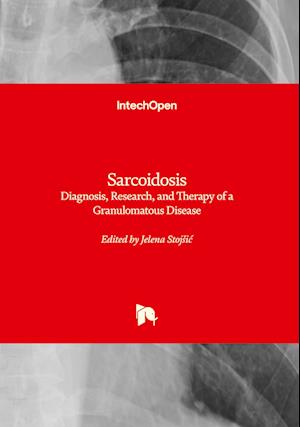 Sarcoidosis - Diagnosis, Research, and Therapy of a Granulomatous Disease