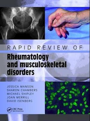 Rapid Review of Rheumatology and Musculoskeletal Disorders