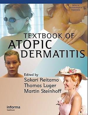 Textbook of Atopic Dermatitis