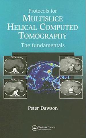 Protocols for Multislice Helical Computed Tomography