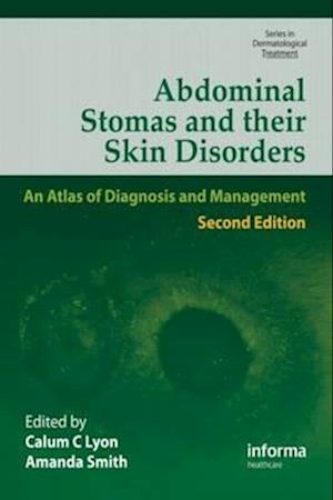 Abdominal Stomas and Their Skin Disorders