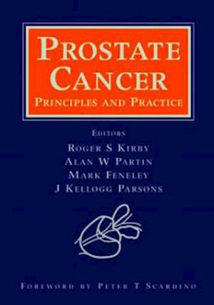 Prostate Cancer