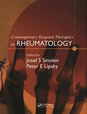 Contemporary Targeted Therapies in Rheumatology