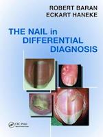 Nail in Differential Diagnosis