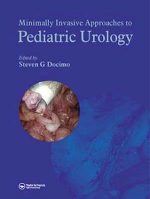 Minimally Invasive Approaches to Pediatric Urology