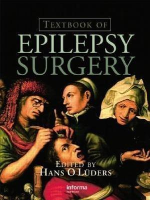 Textbook of Epilepsy Surgery