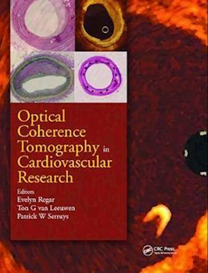 Optical Coherence Tomography in Cardiovascular Research