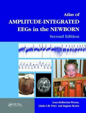 An Atlas of Amplitude-Integrated EEGs in the Newborn