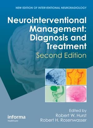 Neurointerventional Management