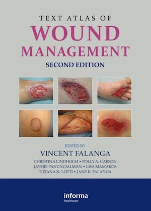 Text Atlas of Wound Management, Second Edition