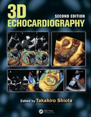 3D Echocardiography