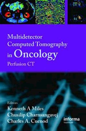 Multi-Detector Computed Tomography in Oncology