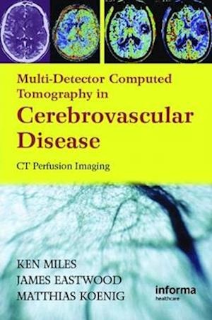 Multidetector Computed Tomography in Cerebrovascular Disease