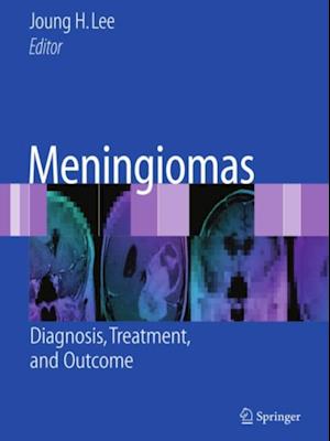 Meningiomas