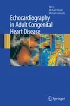 Echocardiography in Adult Congenital Heart Disease