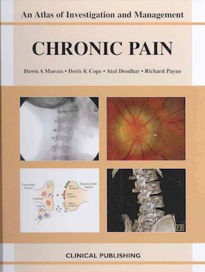 Chronic Pain