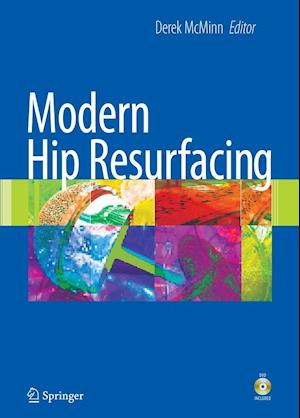 Modern Hip Resurfacing