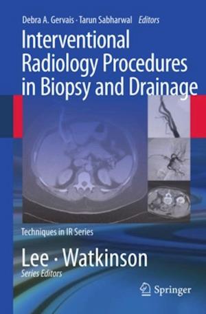 Interventional Radiology Procedures in Biopsy and Drainage