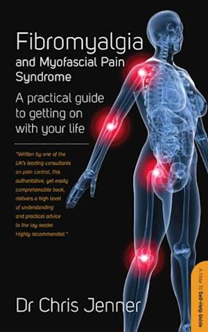 Fibromyalgia and Myofascial Pain Syndrome