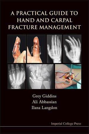 Practical Guide To Hand And Carpal Fracture Management, A